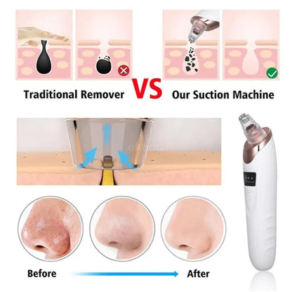 Face Vacuum Suction Blackhead removal for nose And Face